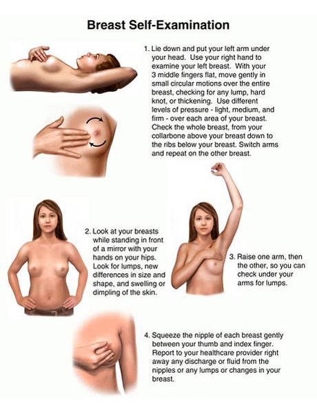 How To Self-Examine Your Breasts